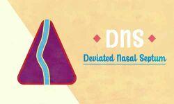 Deviated Nasal Septum (DNS)- Standard Treatment Guideline By Government Of India