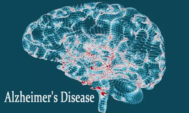 New Convenient Way To Diagnose Alzheimer'S Disease From Nasal Discharge