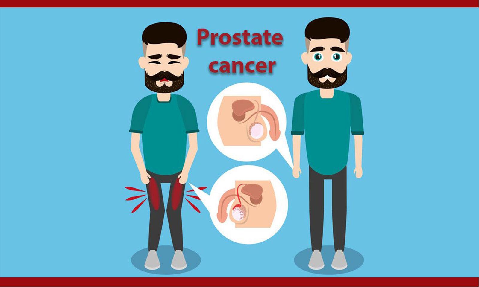 Statins Improve Survival In Prostate Cancer Treated With ADT, Finds Study