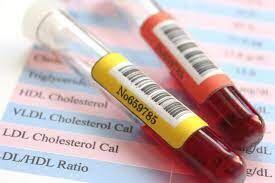 Elevated Eosinophil Count An Independent Risk Factor For Metabolic Syndrome: Study