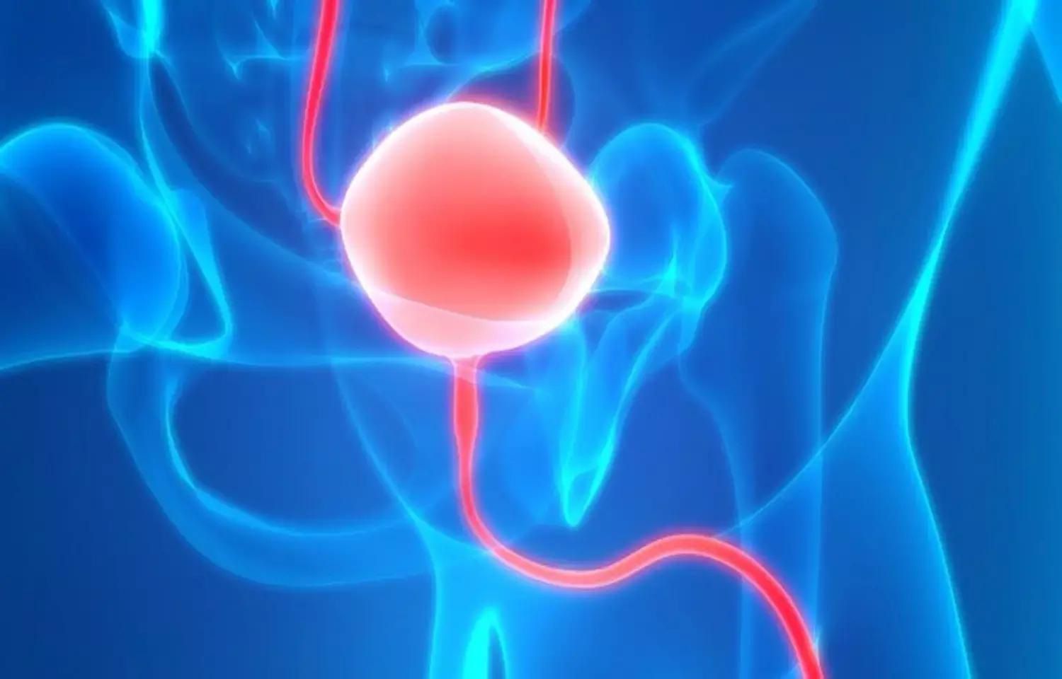 Following Checkmate-274 Trial, FDA Approves Adjuvant Nivolumab For High-Risk Urothelial Carcinoma