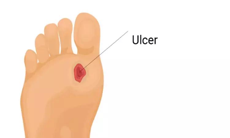 Hyperbaric Oxygen Effective Option For Non Healing Chronic Diabetic Foot Ulcers