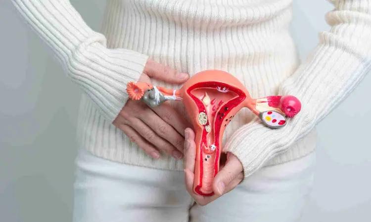 New Consensus Statement By Society Of Radiologists May Improve Endometriosis Evaluation