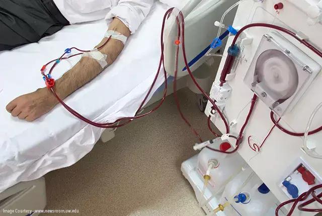 Inadequate Zinc Intake In Hemodialysis Patients Tied To Higher Mortality Risk: Study
