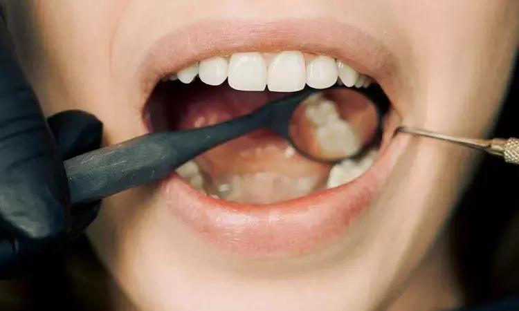 Using Custom Abutments And Permanent Cement Tied To Better Retention Of Zirconia And Metal-Ceramic Single Crowns: Study