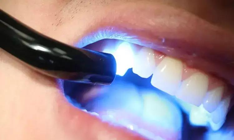 Resin-Based Composites Containing Finer Fillers Best Maintain Glossiness After Routine Tooth Brushing: Study