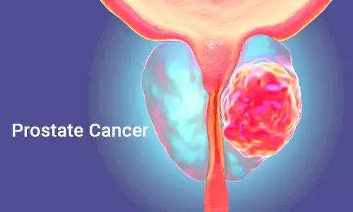 Statins Increase Survival In Men With High-Risk Prostate Cancer: Study