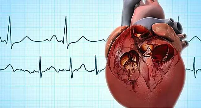 IV Diltiazem Tops Metoprolol For Treating Patients Of Atrial Fibrillation With Rapid Ventricular Rate: Study
