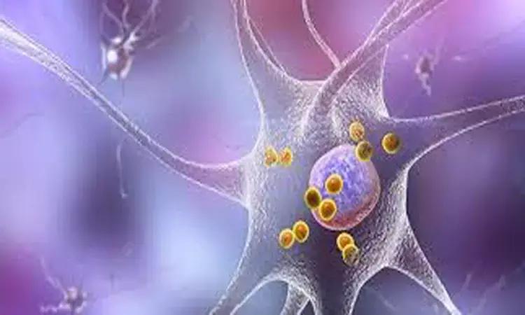 Higher Caffeine And Urate Levels Protect Against Parkinson'S Disease: Study