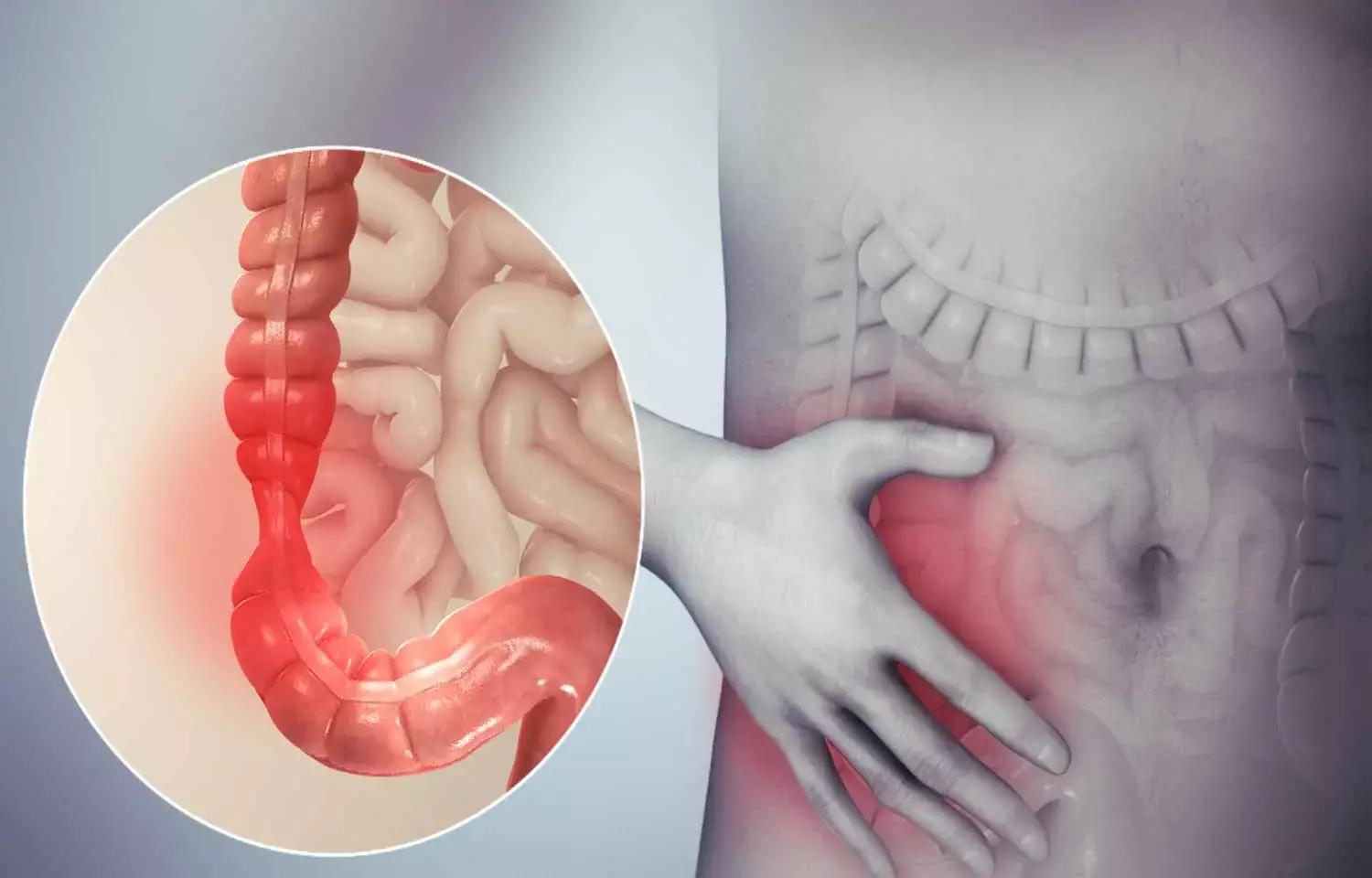 FODMAP Diet Exacerbates Symptoms Of Irritable Bowel Syndrome, Finds Study