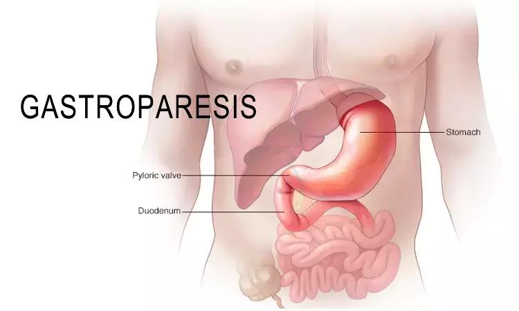 Tradipitant Shows Promise In Alleviating Nausea In Gastroparesis