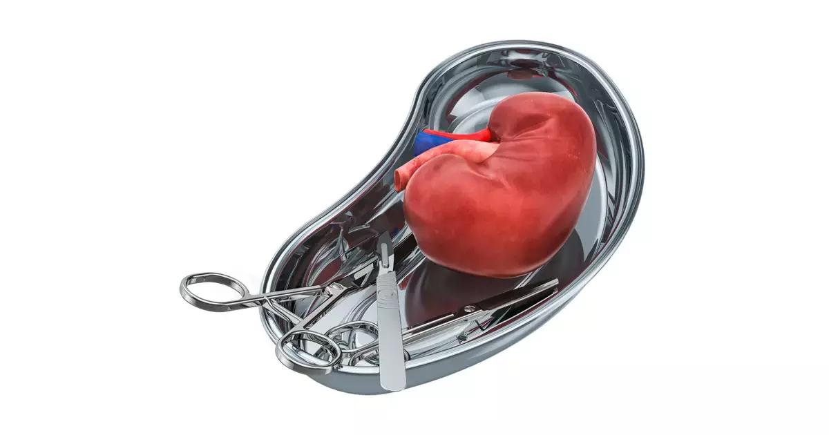 In Kidney Transplant Patients With COVID-19, Withdrawal Of Immunosuppressants Safe