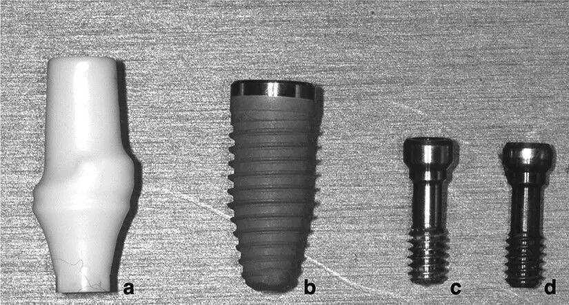 Use Of Standard Zirconia Abutments Yield Better Esthetic Outcomes Compared With Titanium Abutments