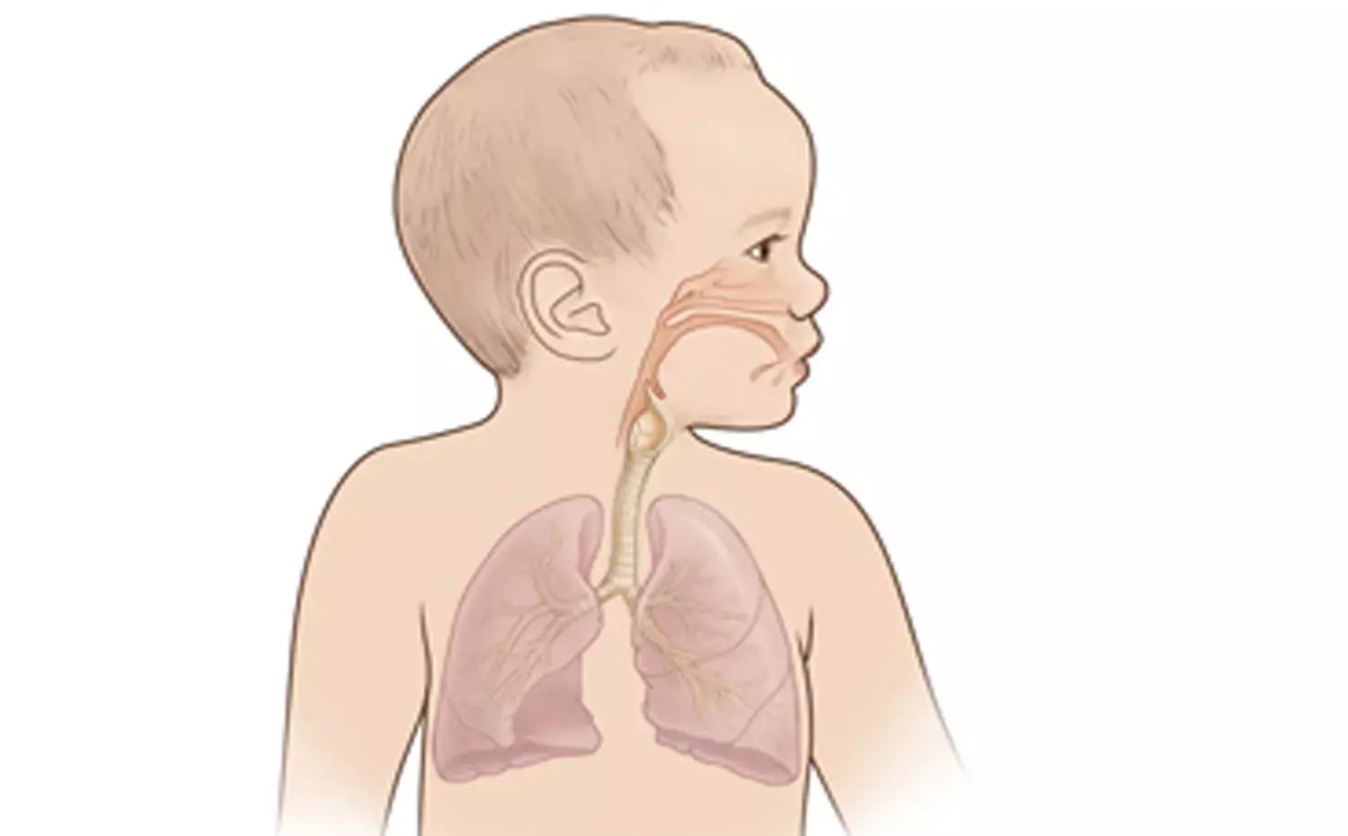 In Preterm Babies, Lung Ultrasound Scores Useful To Predict Bronchopulmonary Dysplasia: Study