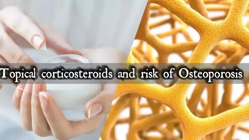 Topical Steroids May Increase Risk Of Osteoporosis, Fractures: JAMA Study