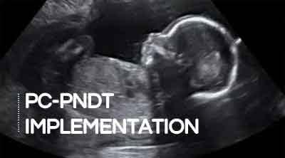 Mandatory Installation Of Active Tracker In Ultrasound Machines : MP High Court Nullifies Order