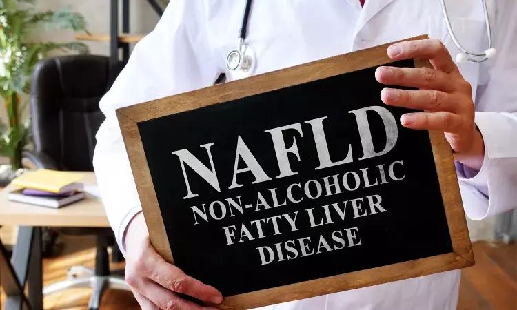 Kisspeptin: A New Drug For Treatment Of NAFLD