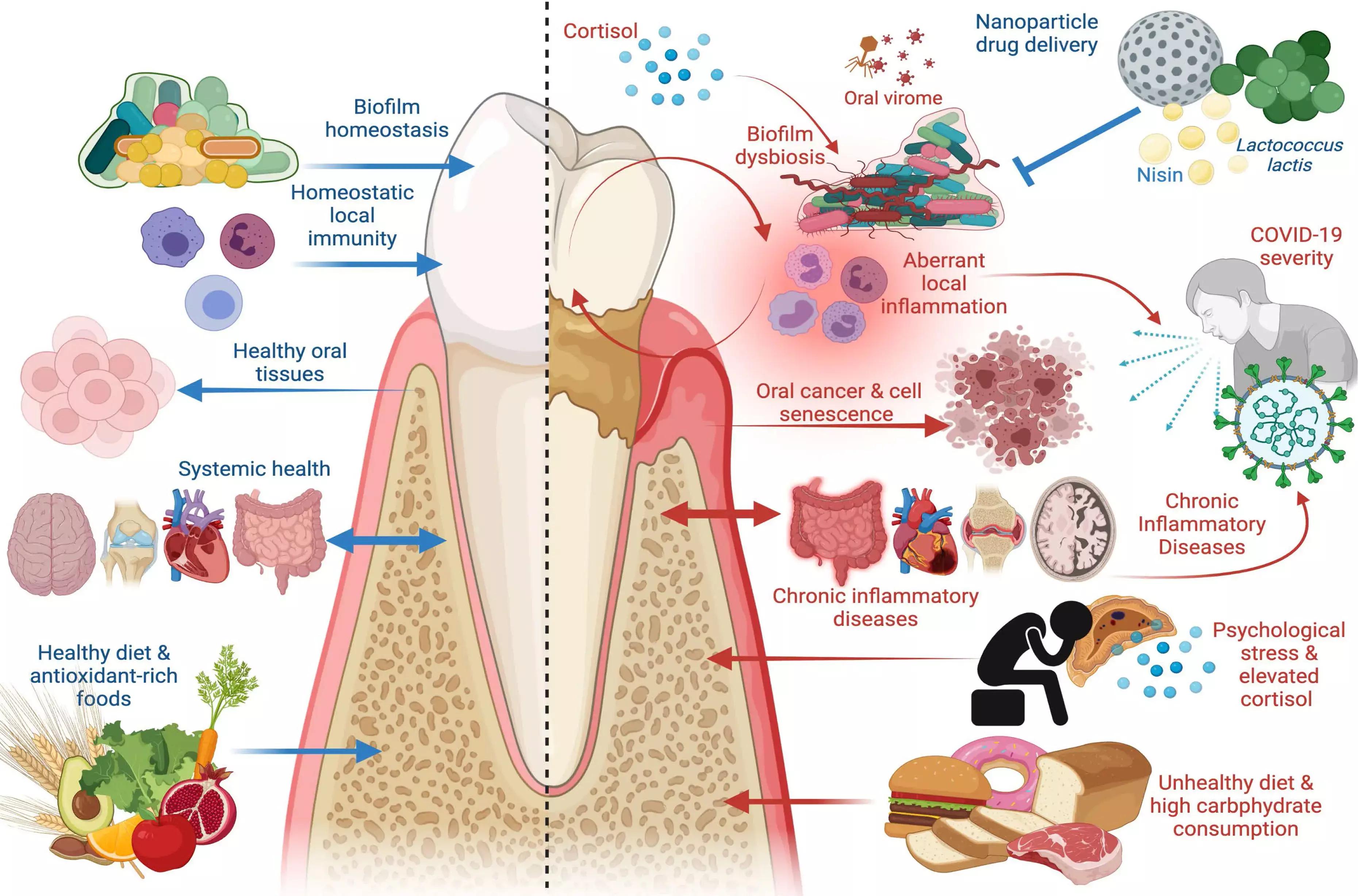 Periodontal Disease Linked To All Cause And Cause Specific Mortality Reveals Study