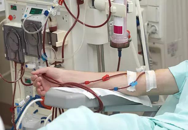 Intradialytic Exercise Regime Is Safe And Effective In Hemodialysis Patients: Study