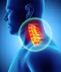 Cervical Pedicle Screw Insertion With Medial Pedicle Pivot Point: A Novel Technique