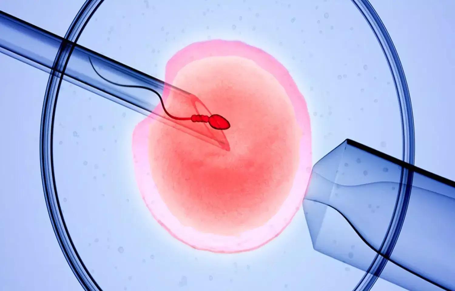 Model Predicts Number Of MII Oocytes Needed To Obtain At Least One Euploid Blastocyst: Study