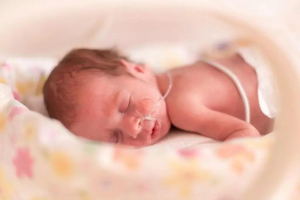Developmental Coordination Disorder High In Children Born Very Preterm, Study Reveals