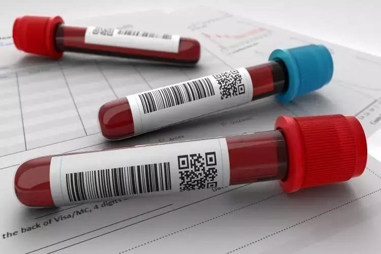 Serum Ferritin Levels Associated With Acute Myocardial Infarction: JAPI