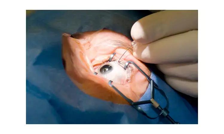 Ophthalmologic Procedures In Outpatient Setting Not Associated With Risk Of MI