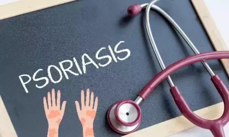 Psoriasis Patients Under Biologic Treatment May Present With Paradoxical Eczema