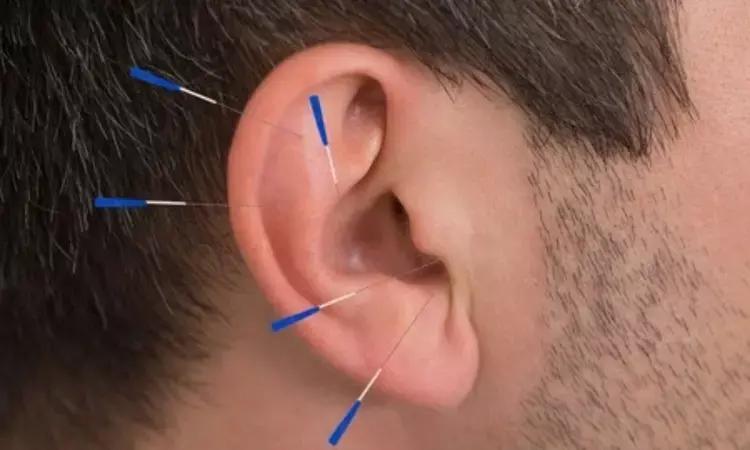 Is Auricular Acupuncture Safe And Effective For Treating Depression? Study Sheds Light