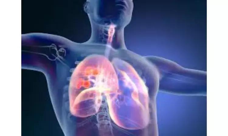 Nivolumab + Ipilimumab: Added Benefit In Pleural Mesothelioma With Non-Epithelioid Tumour Histology