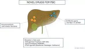 Seladelpar Significantly Improves Liver Biochemistry And Pruritus In Patients With Primary Biliary Cholangitis