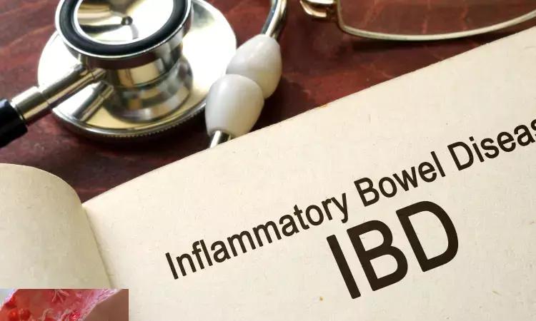Sarcopenia In IBD Patients Associated With Worse Outcomes