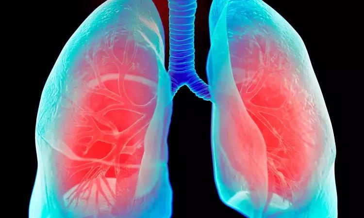 Long COVID' Linked To Small Airways Involvement Independent Of COVID-19 Severity