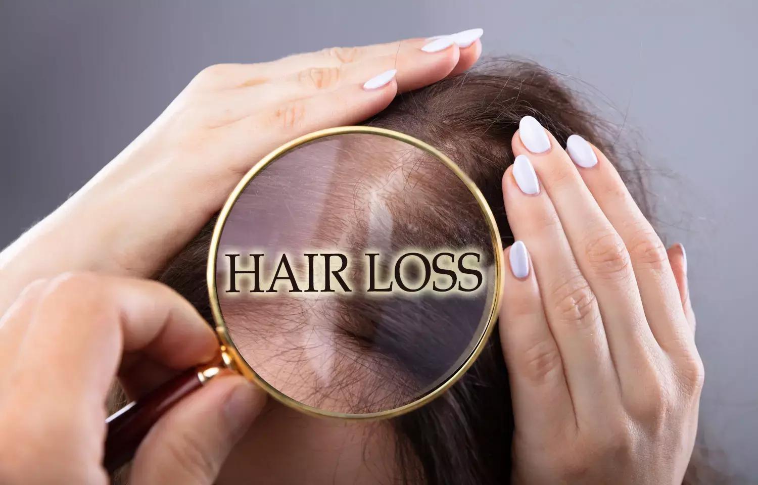 Hair Loss Frequent In Acne Patients Treated With Low Dose Isotretinoin Vs High Dose