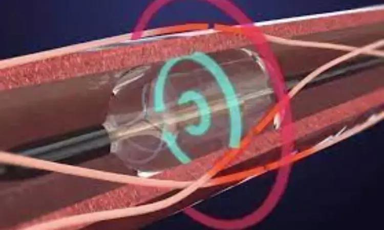 FDA Panel Backs Ultrasound-Based Renal Denervation System For Uncontrolled Hypertension