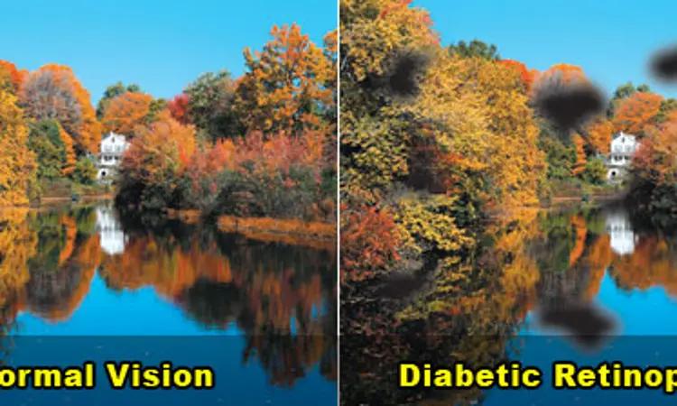 Bariatric Surgery May Worsen Existing Serious Diabetic Retinopathy: Study