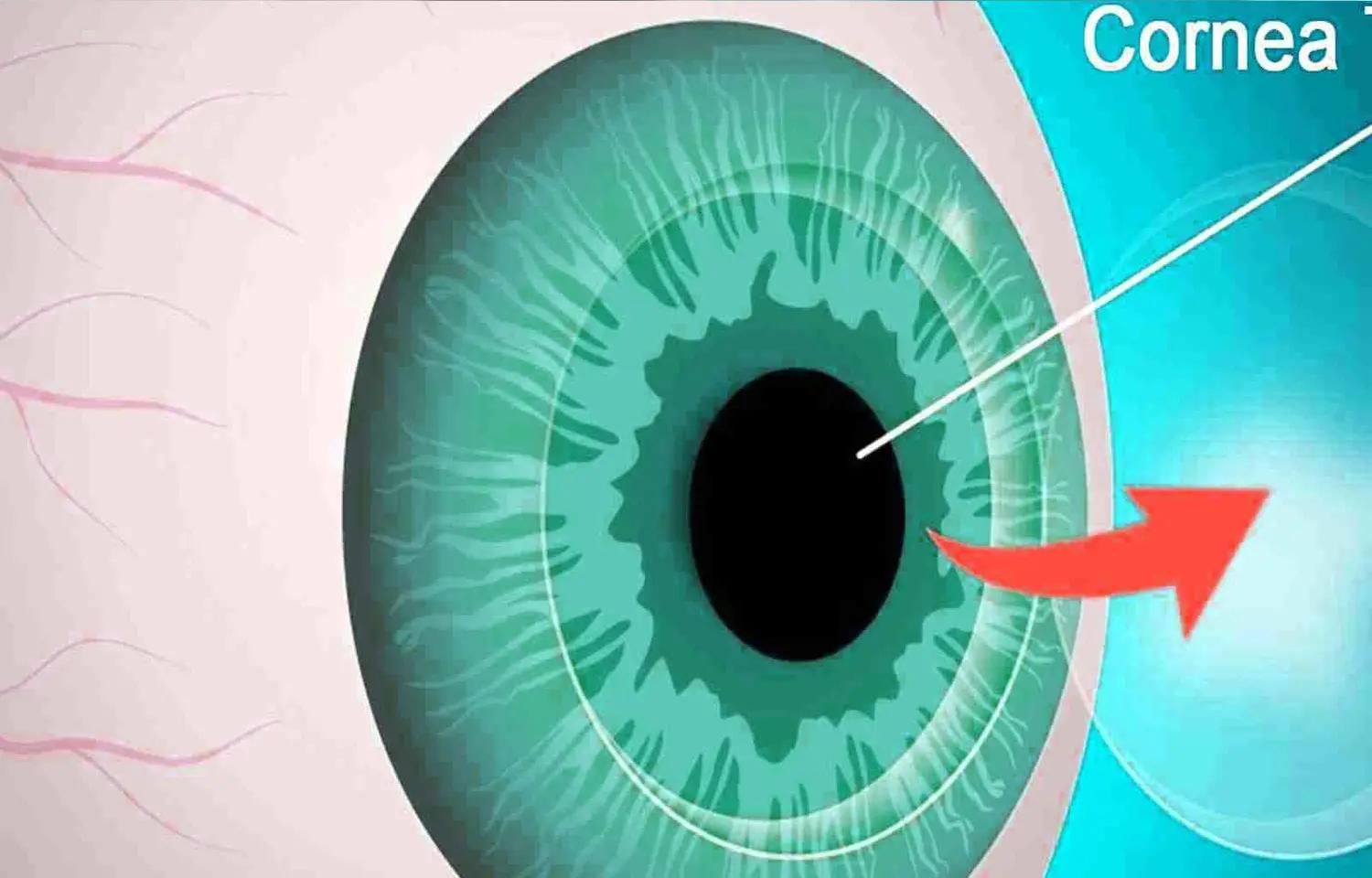 Case Of Cutaneous Melanoma Presenting With Pigmented Corneal Mass: Clinical Challenge