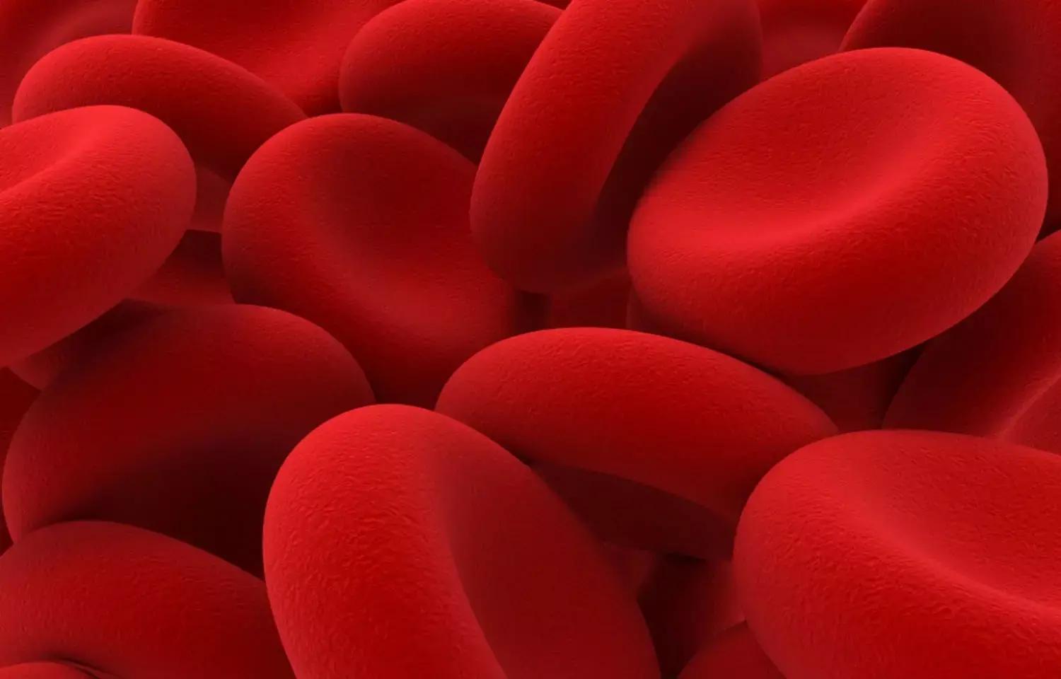 Low HbA1c Levels Linked To Iron Deficiency Anemia In Non-Diabetic Saudi Women;Finds Study