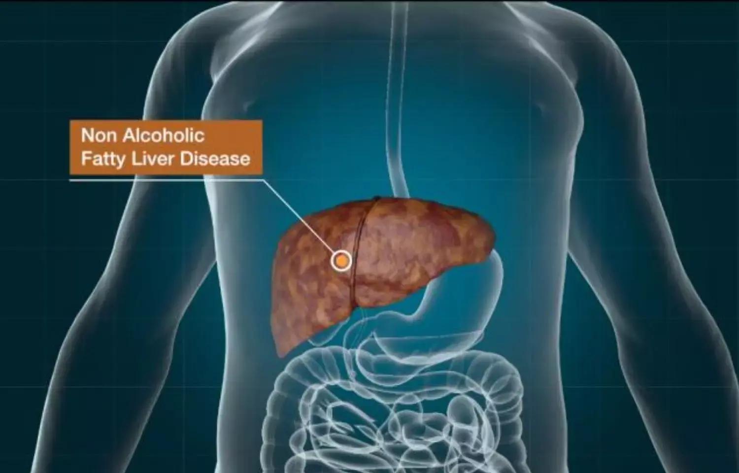 Women With Prediabetes And Diabetes At Higher Risk Of NAFLD Than Men, Says Study