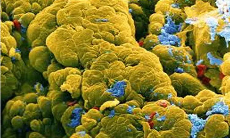Easy Home Cancer Test May Help Patients Avoid Hospital Visits For Colonoscopies