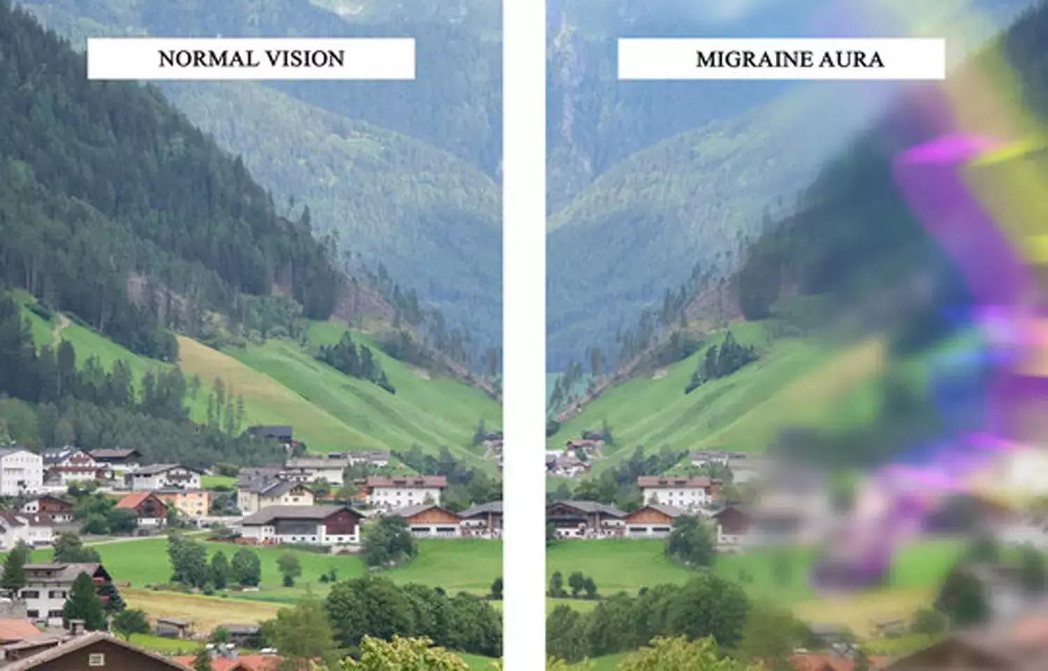Migraine May Increase Risk Of All Types Of Retinal Artery Occlusion: Study