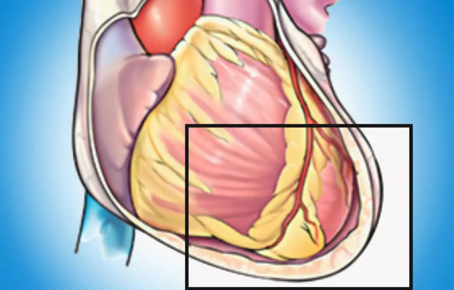 Study Of Genetics Of Pericarditis Reveals Interleukin-1 Immune Cytokines Inhibitors As Breakthrough Treatment