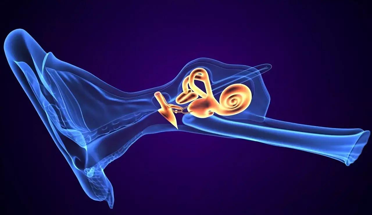 Morphological Characteristics Of Vestibular Aqueduct Associated With Occurrence Of Meniere Disease: Study