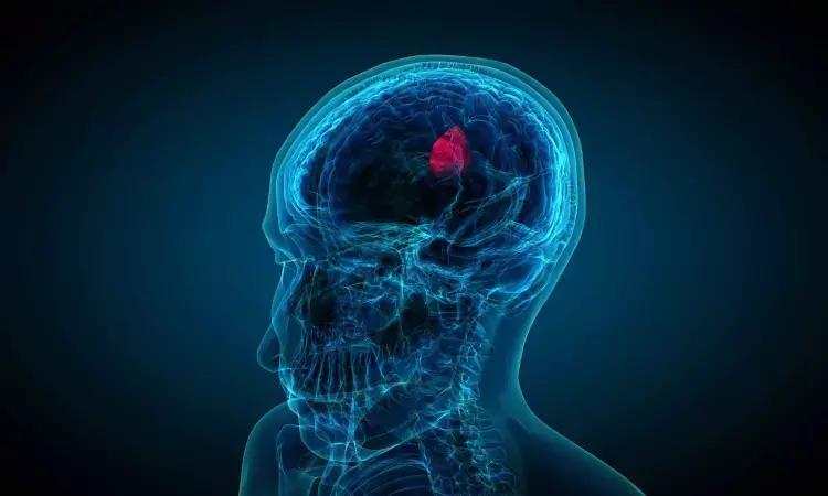 Vorasidenib A Potential Breakthrough Treatment For IDH-Mutant Gliomas