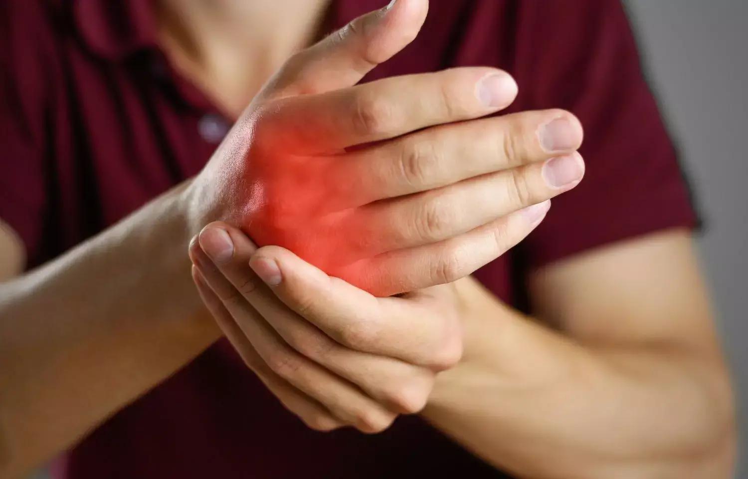 Bimekizumab Cost Effective Treatment Option For Psoriatic Arthritis