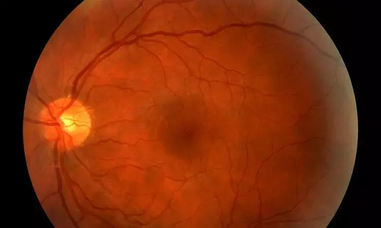 Diabetes Patients With Glaucoma Have Heightened Risk Of Developing Retinopathy