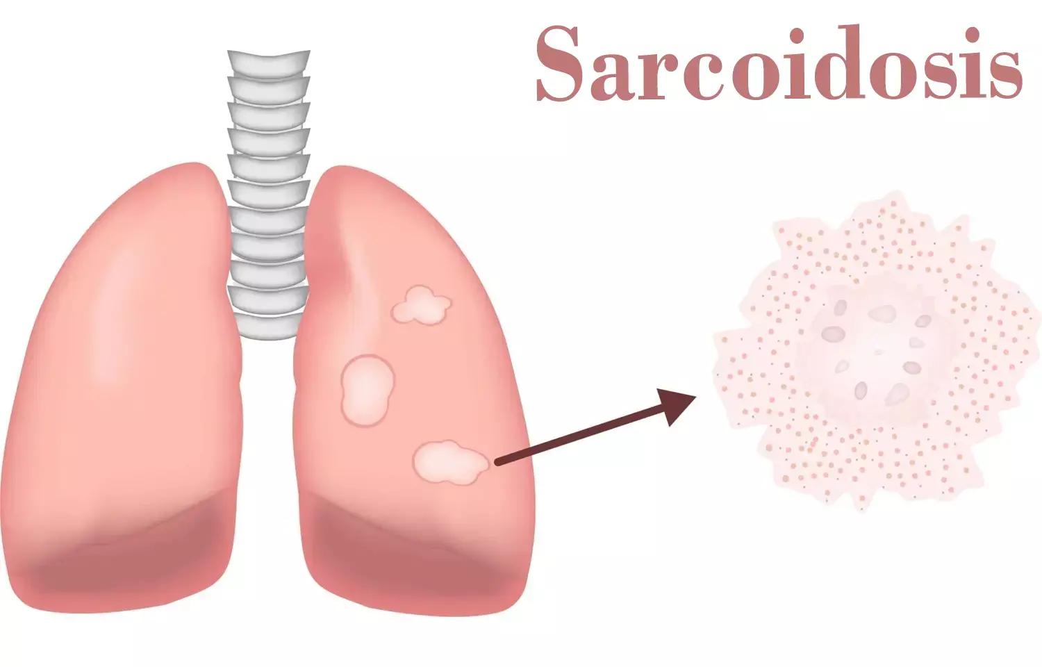 Tofacitinib A Potential Treatment For Sarcoidosis: Study