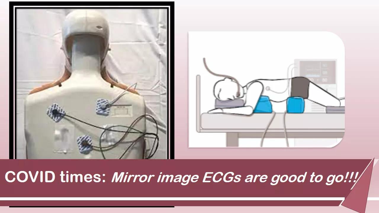 Prone-Back ECG In COVID-19 Patients Useful For Arrhythmia Detection, JACC Study