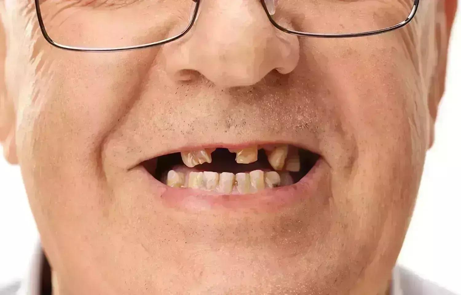 Tooth Loss Associated With Cognitive Decline In Older Adults
